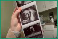 Counting On Alum Joy-Anna Forsyth Updates At 33 Weeks Pregnant